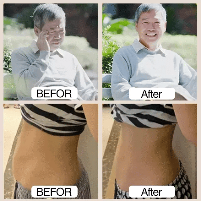 WellnessPro LI4 Sugar Balance Clip – Buy 1 Get 1 Free!