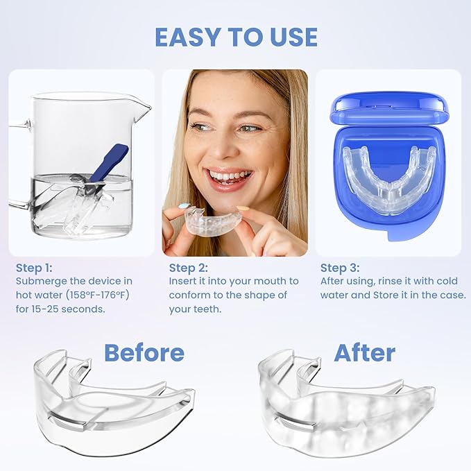 Magical Snoring Stopper – Sleep Silent Tonight (Permanent_Solution)