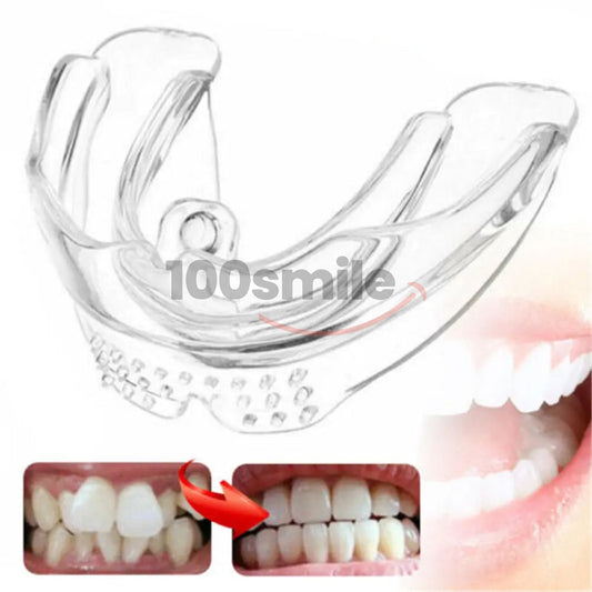 Complete 3-Step Ultra Braces Set — Permanent Teeth & Jaw Alignment Solution - Limited Offer